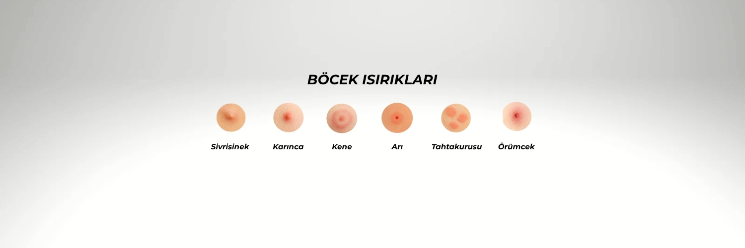 Böcek Isırıkları